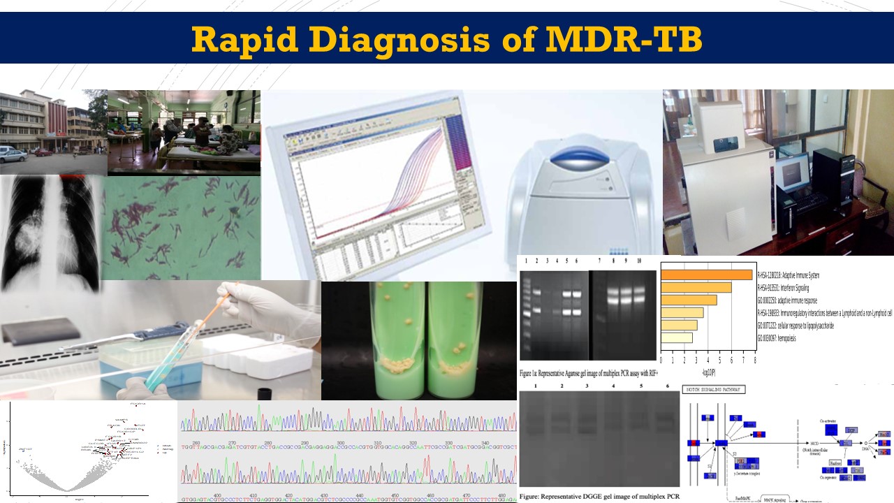 Drug-resistant Mycobacterium tuberculosis isolates (TB) from Sri Lanka and Pakistan